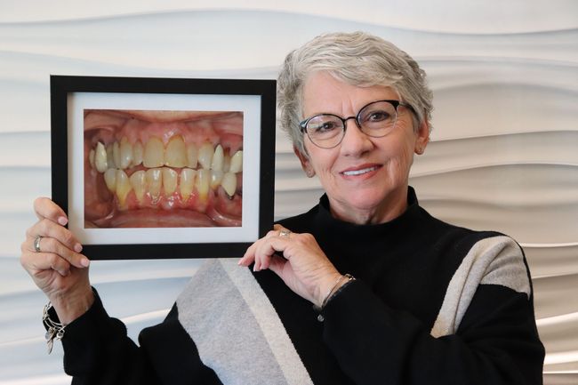 A woman is holding a picture of her teeth in a frame.