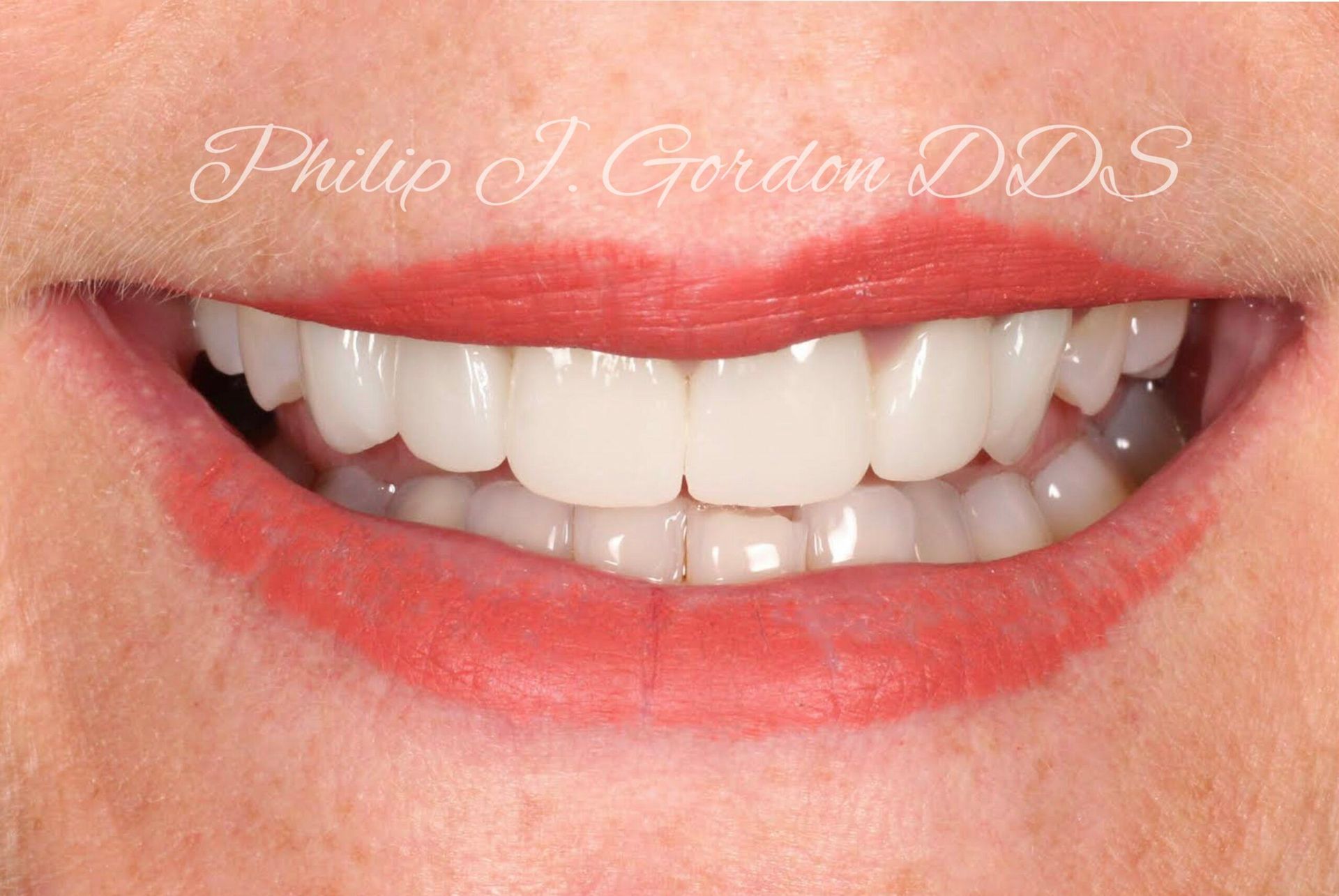 A close up of a woman 's smile with white teeth and red lips.