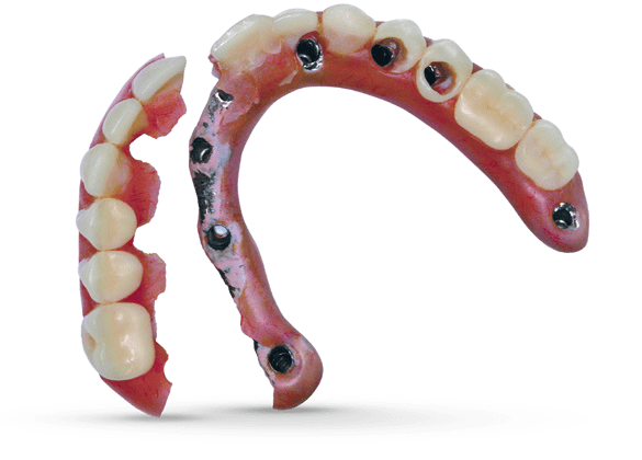 A close up of a broken denture on a white background