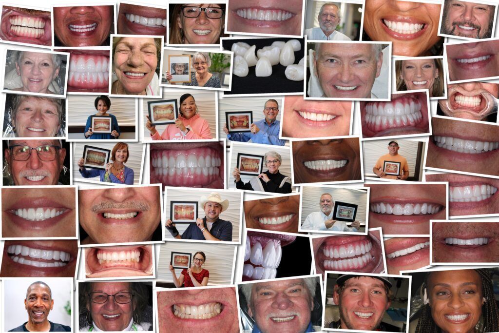 A collage of pictures of people 's smiles and teeth