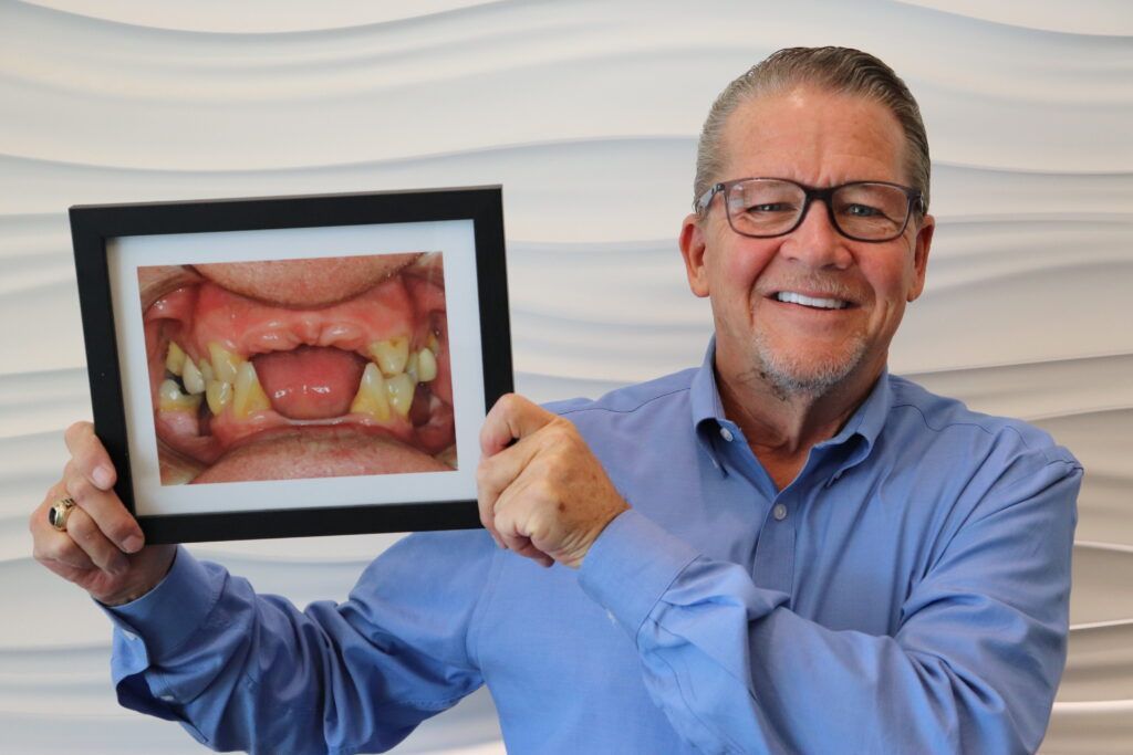 A man is holding a picture of his teeth in a frame.