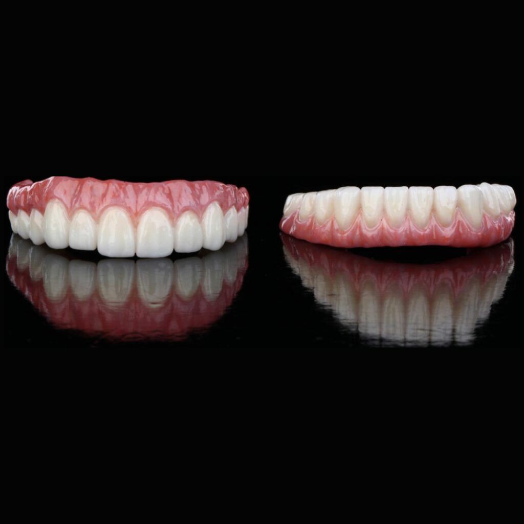 A pair of dentures are sitting next to each other on a black surface.