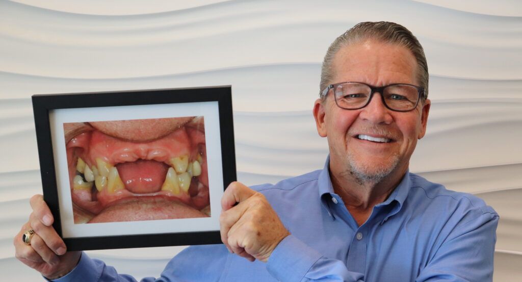 A man is holding a picture of his teeth in a frame.