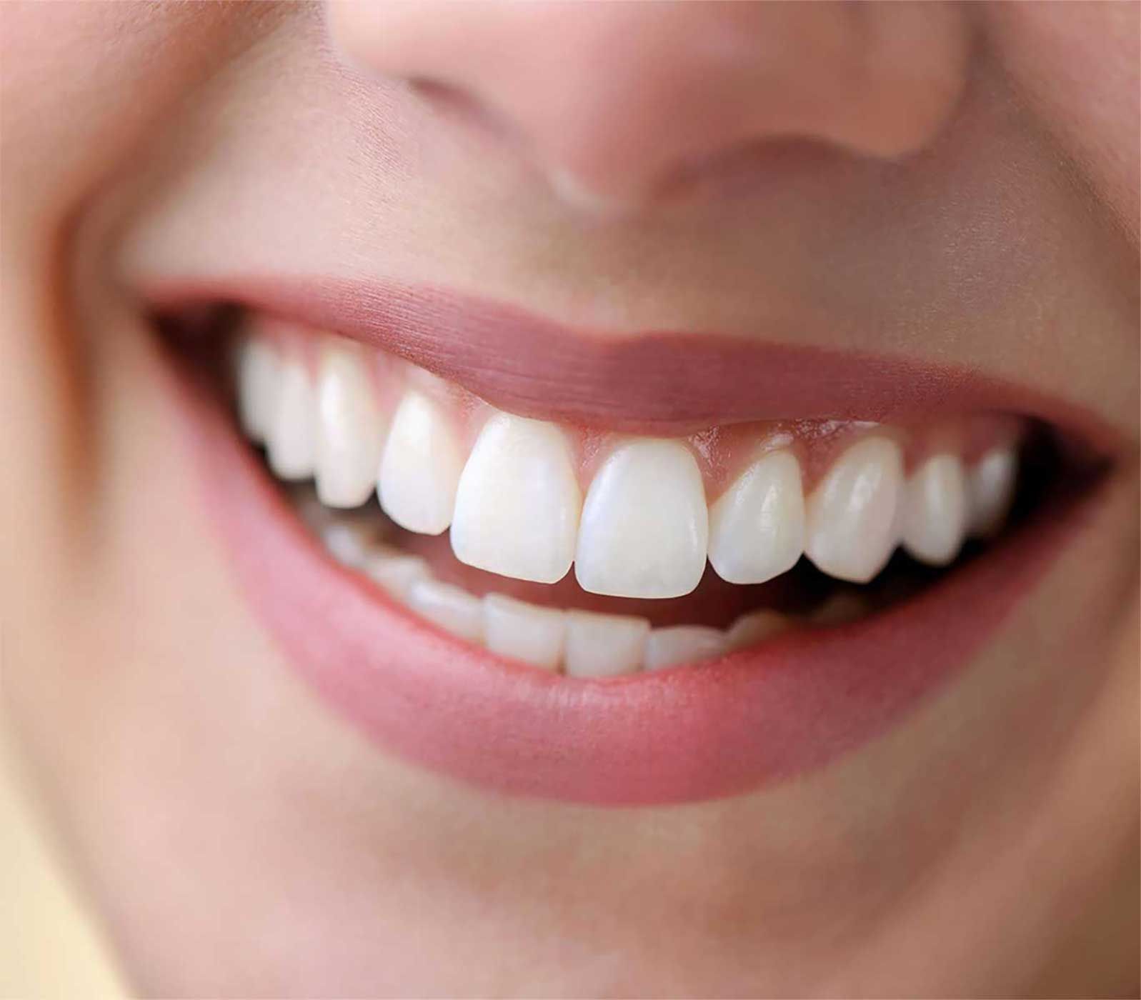 A close up of a woman 's smile with white teeth and pink lips.