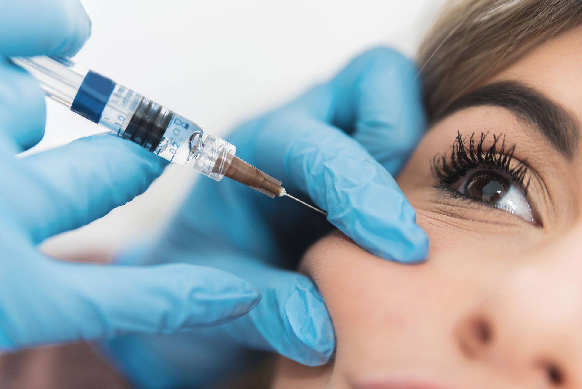DERMAL FILLER - JUVEDERM
