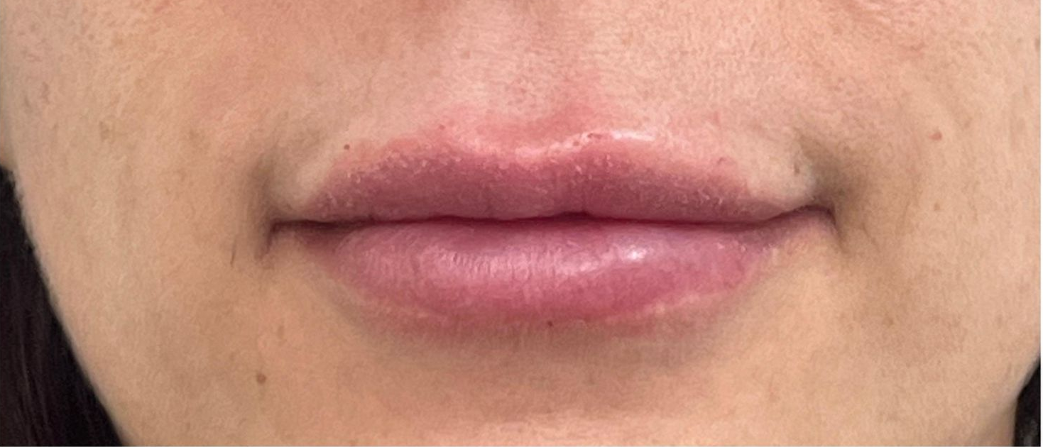 Close-up of a person's lips. They are full, glossy, and light pink in color.