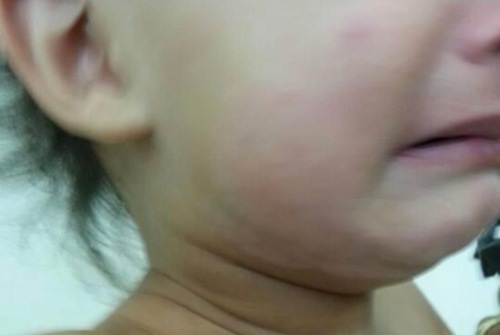 Close-up of a person's lips. They are full, glossy, and light pink in color.
