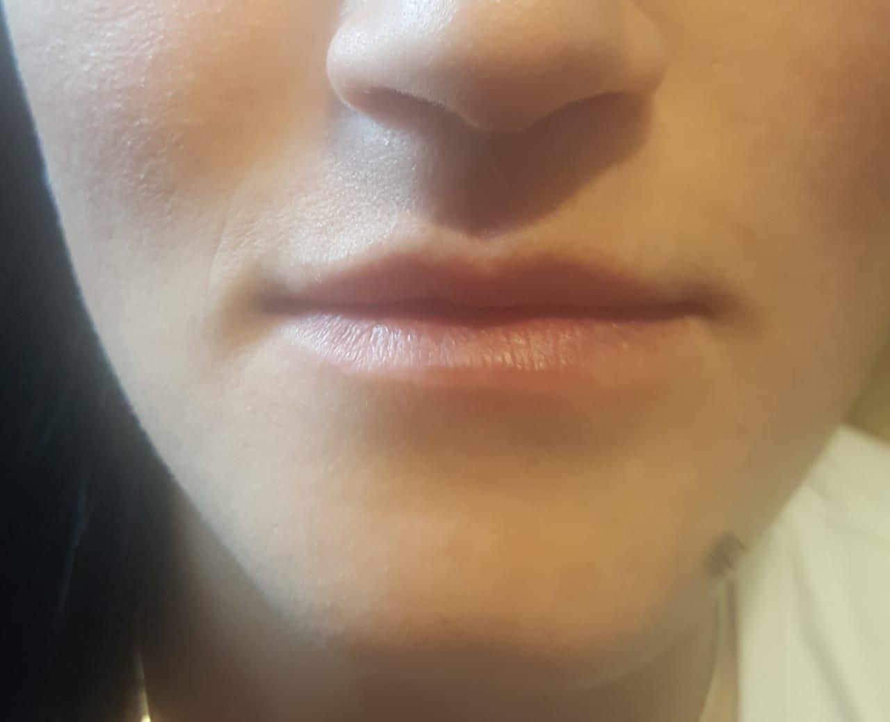 Close-up of a person's face, focusing on the lips, nose, and chin. Skin is fair.
