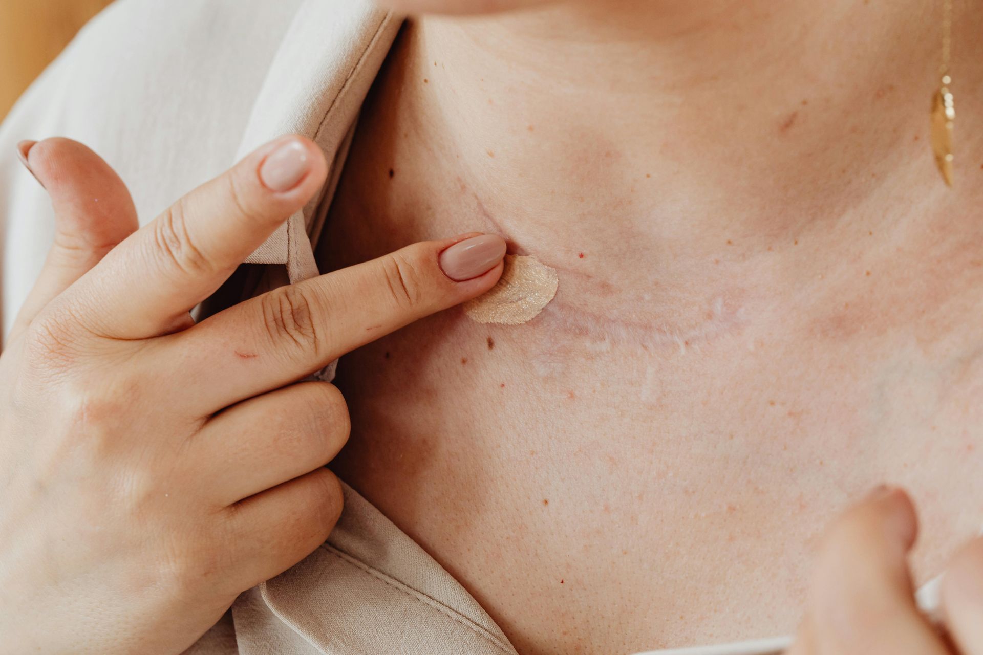 Woman's face showing skin irritation, redness, and spots on the cheek and jawline.