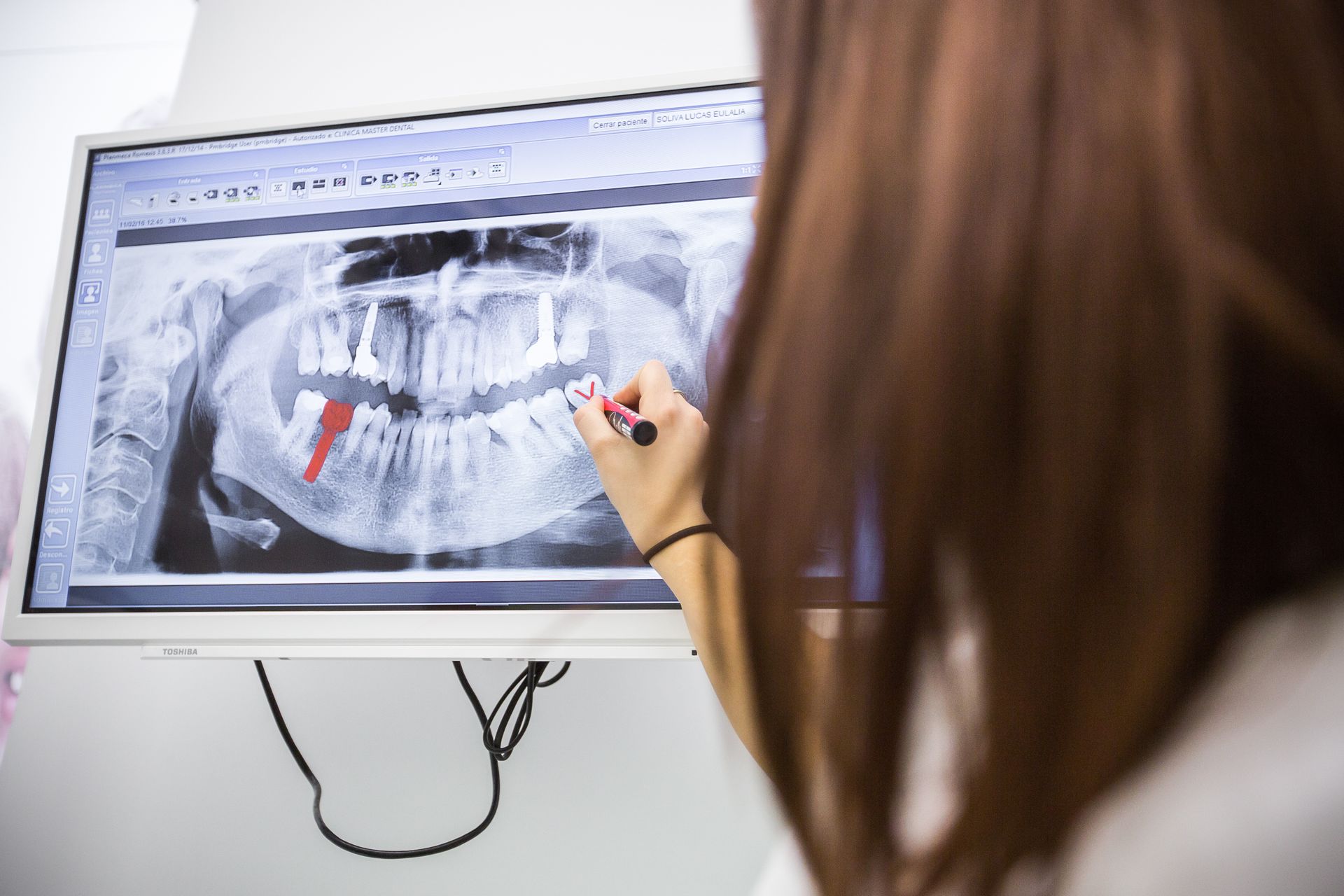 Dentist points to a tooth on a panoramic dental X-ray displayed on a monitor.