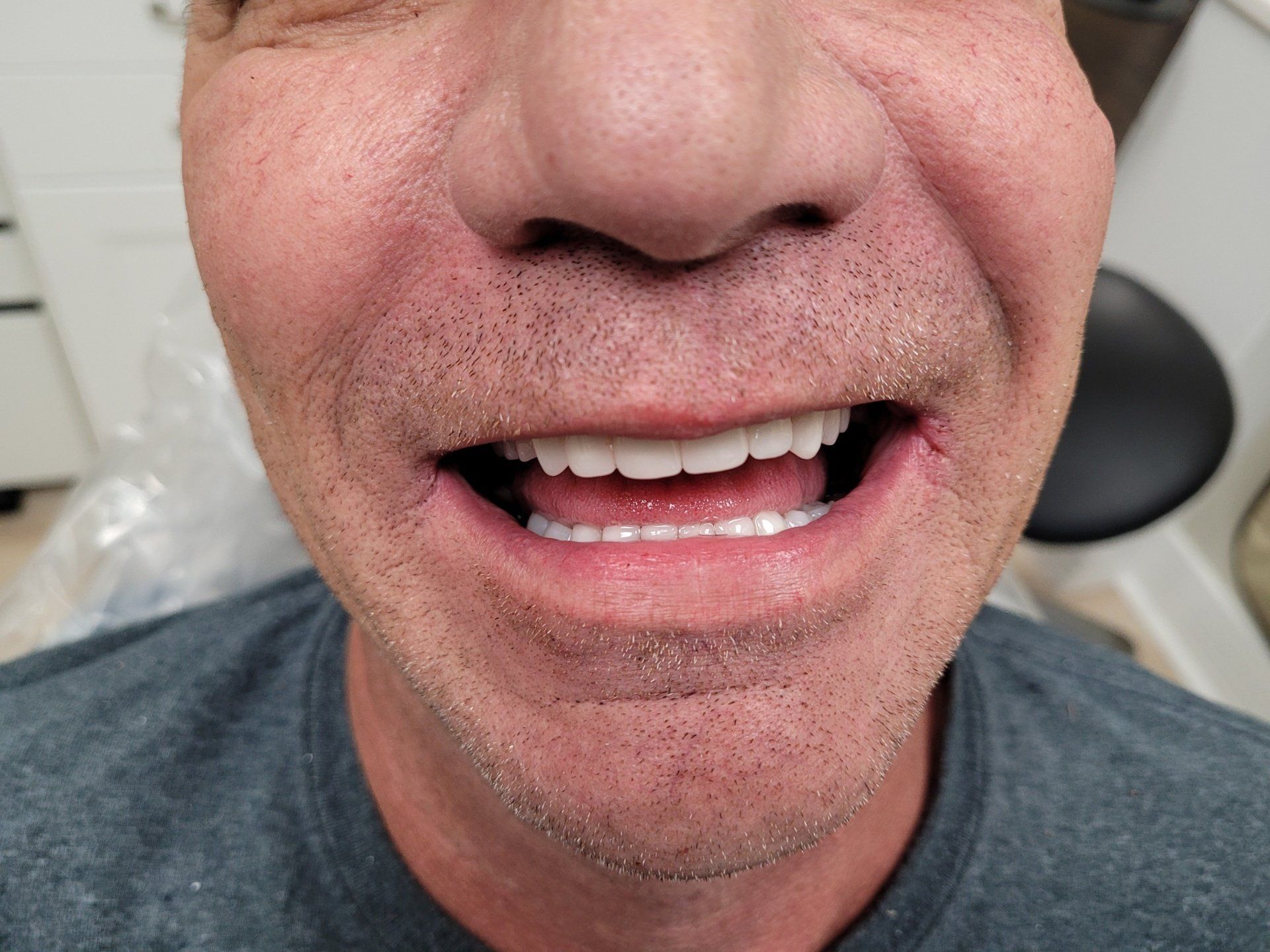 A close up of a man 's mouth with white teeth.