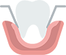 Root Canals, Crown & Bridges