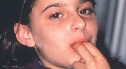 A young girl is covering her mouth with her hand.