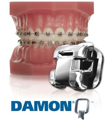 A model of a person 's teeth with braces and the word damon on the bottom