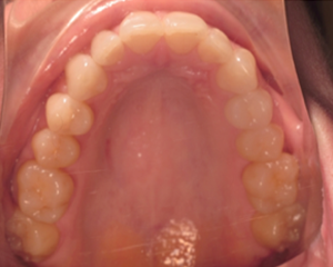 A close up of a person 's mouth showing their teeth