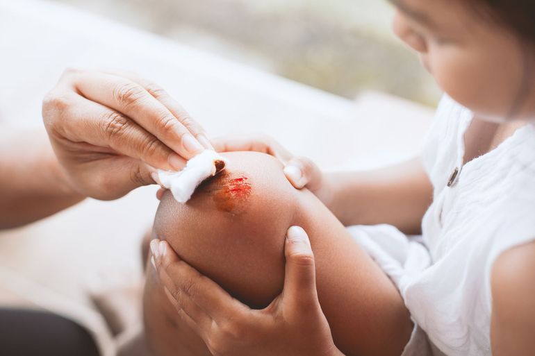 A child is getting a bandage on their knee.