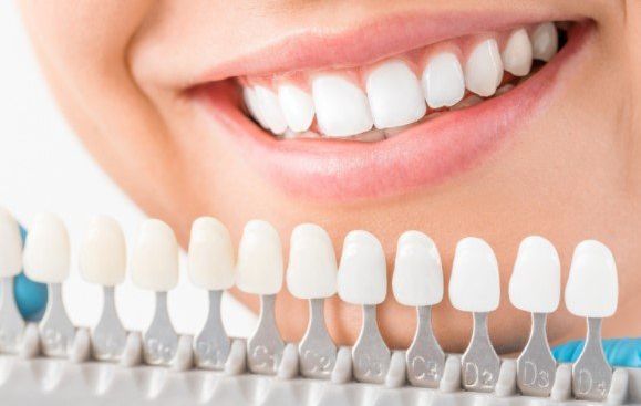 Dr. Jeffrey Wert & Associates, teeth whitening