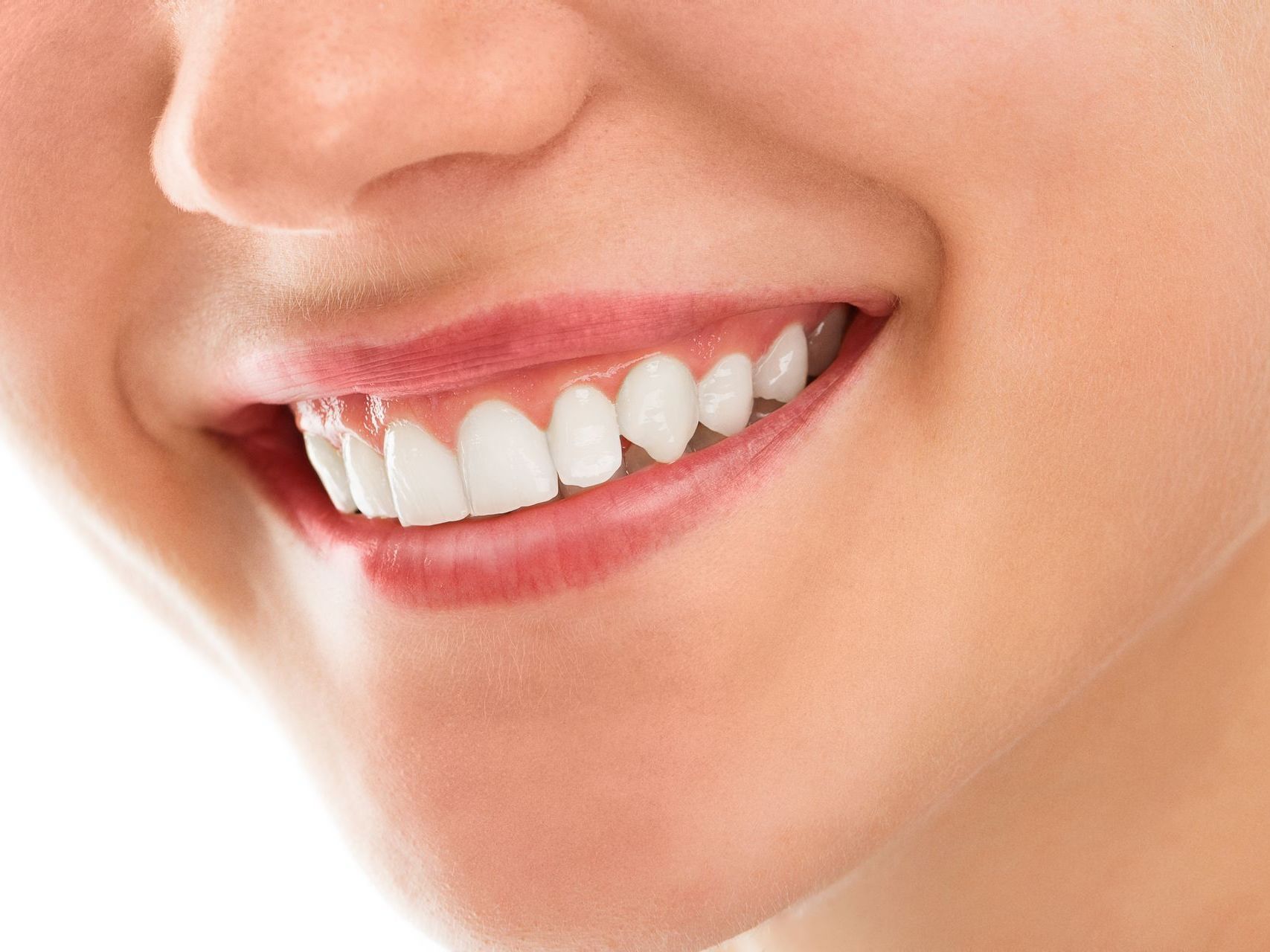 a close up of a woman 's smile with white teeth .