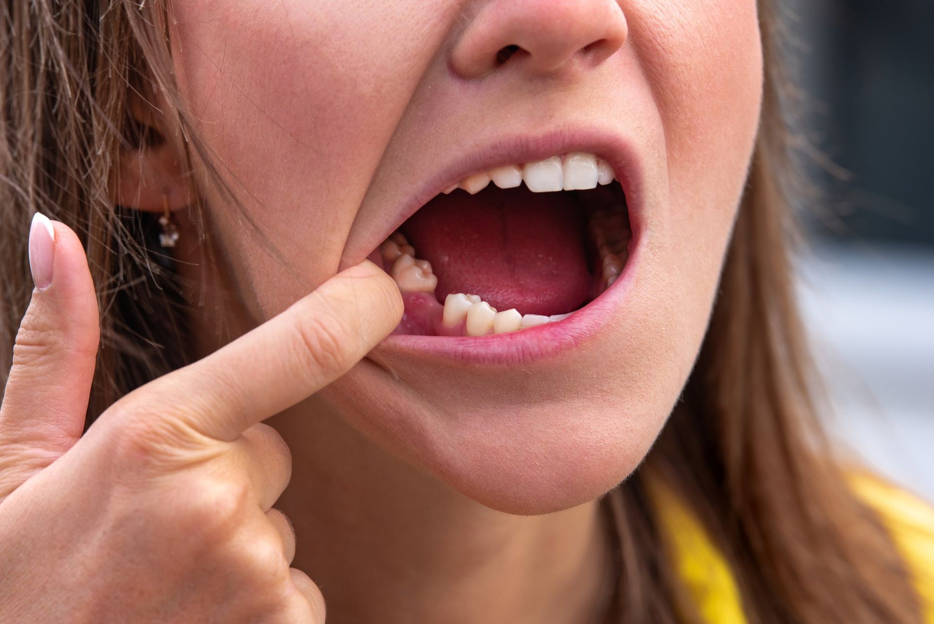 a woman is pointing at her missing tooth in her mouth .