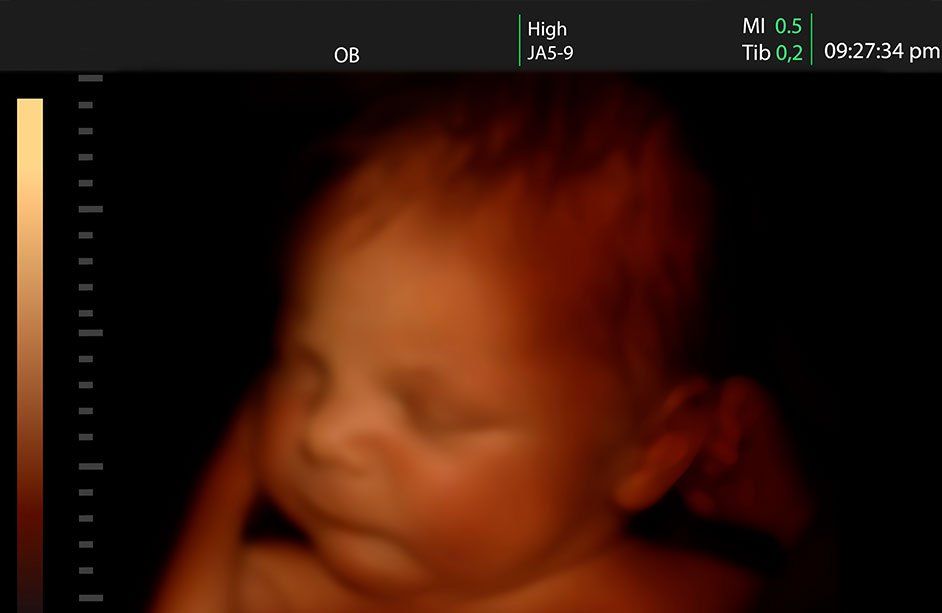 Centro médico Santa Anita-Ecografia-4D