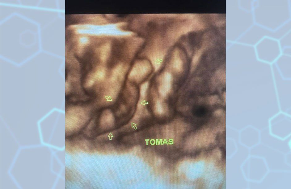 Centro médico Santa Anita-Perfil Biofísico