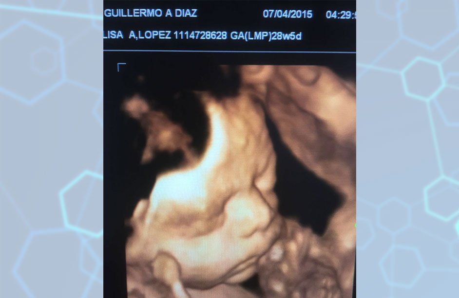 Centro médico Santa Anita-Perfil Biofísico