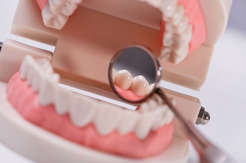 een close-up van een tandmodel met een tandspiegel.