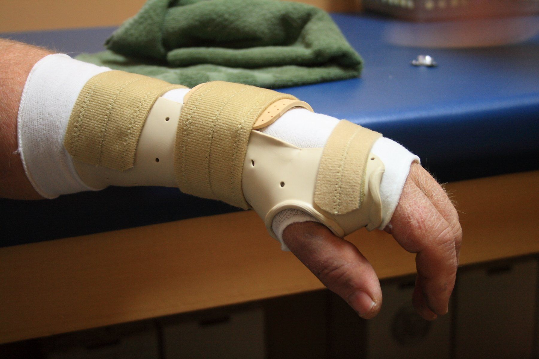 Thermoplastic Wrist Splint — Wetherill Park, NSW — JQ Physiotherapy & Sports Rehabilitation