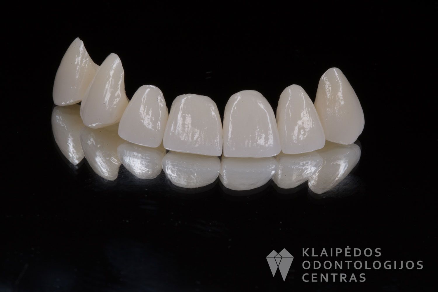 Priekinių dantų cirkonio keramikos vainikėliai