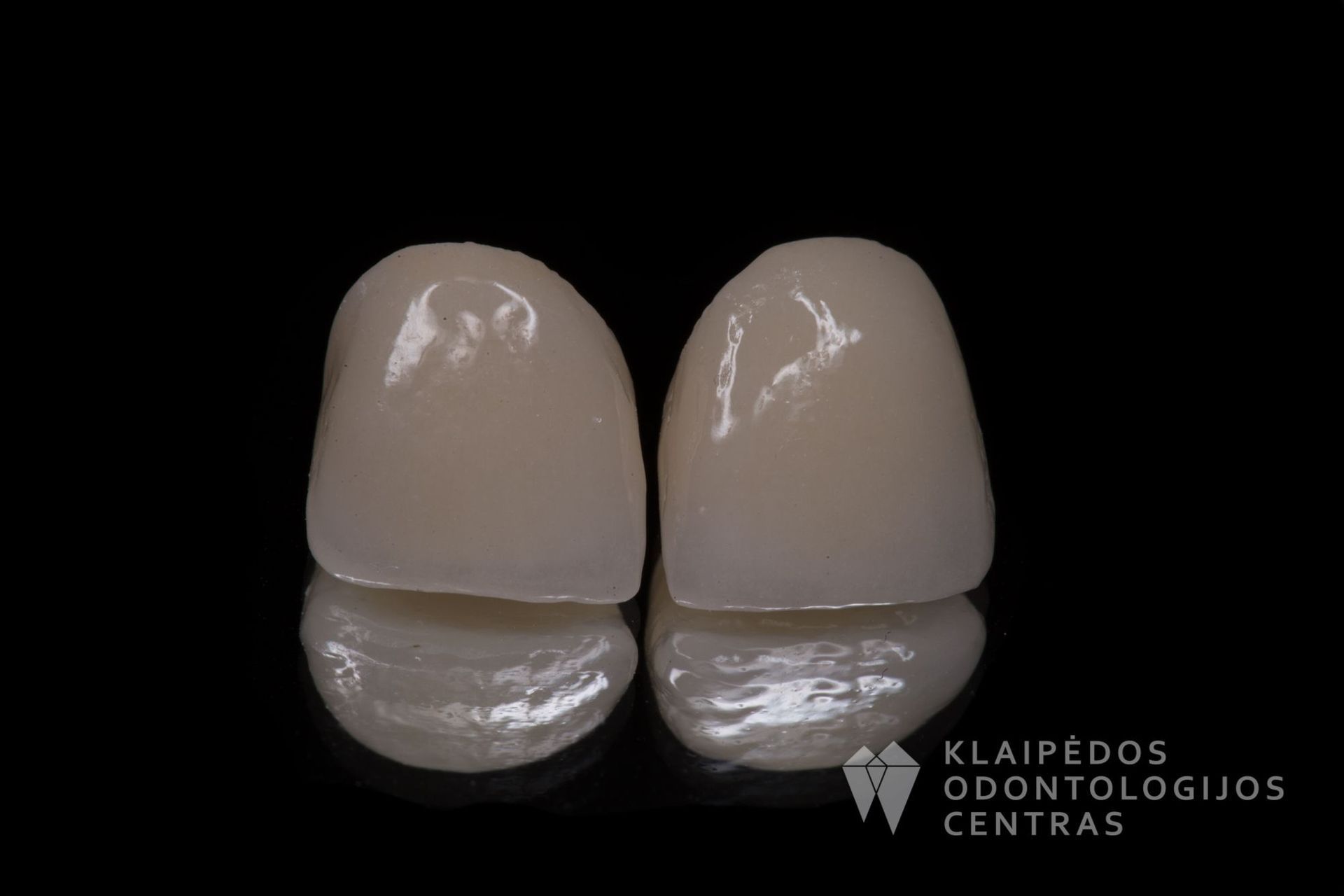 Priekinių dantų cirkonio keramikos vainikėliai