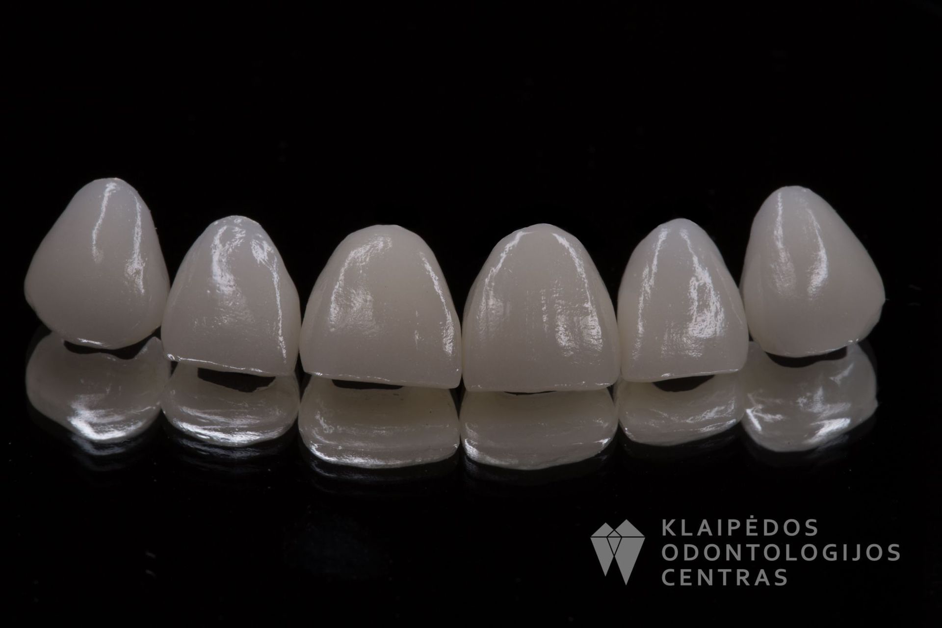 Šešių priekinių dantų laminatės
