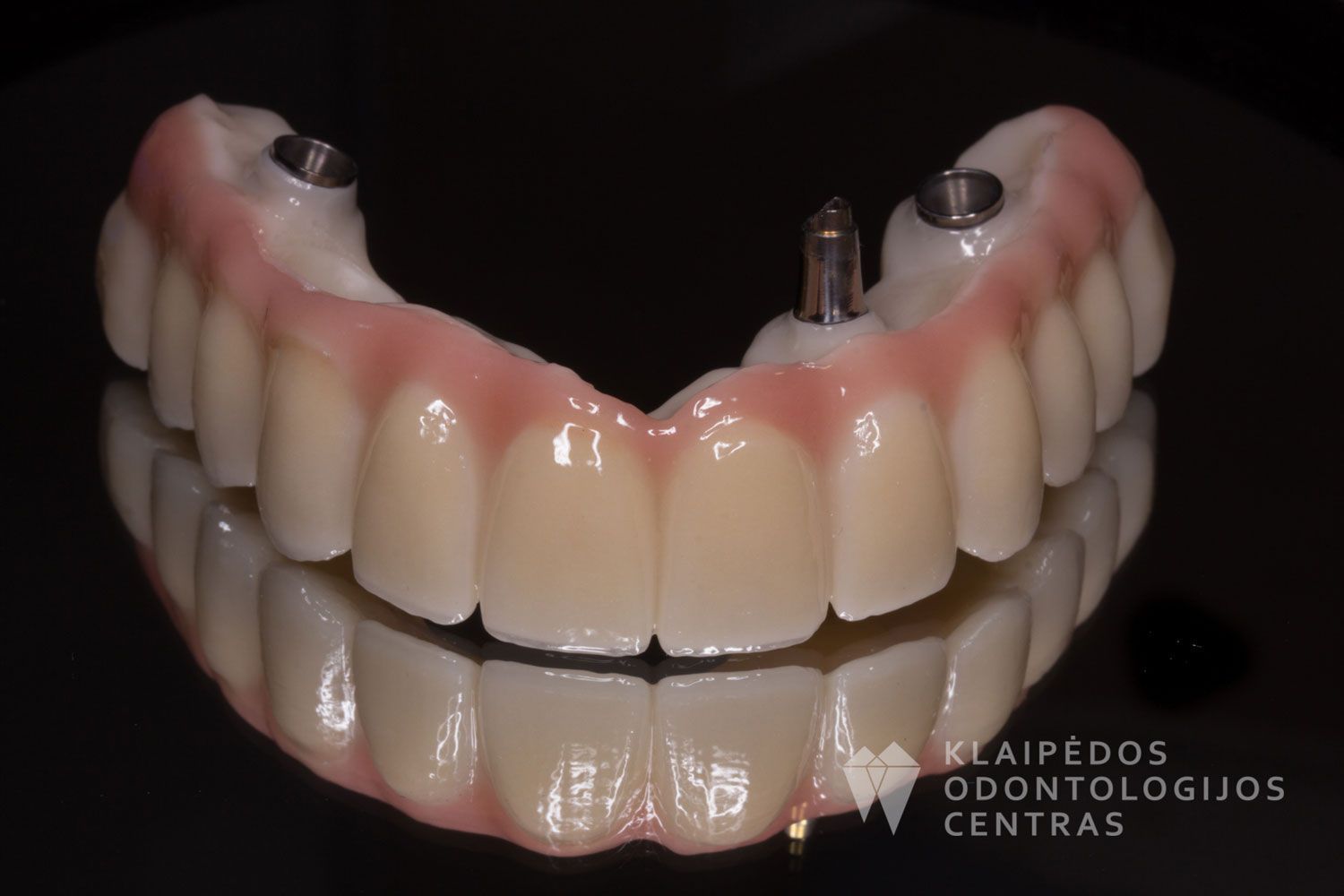 Cirkonio keramika ant 4 implantų