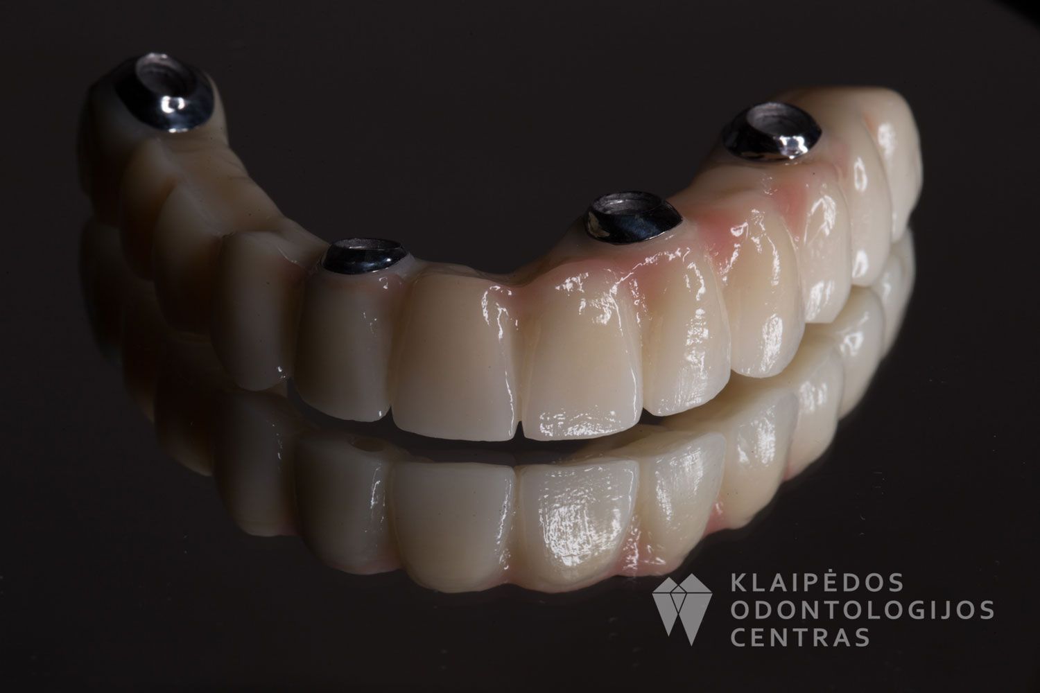 Cirkonio keramika ant 4 implantų