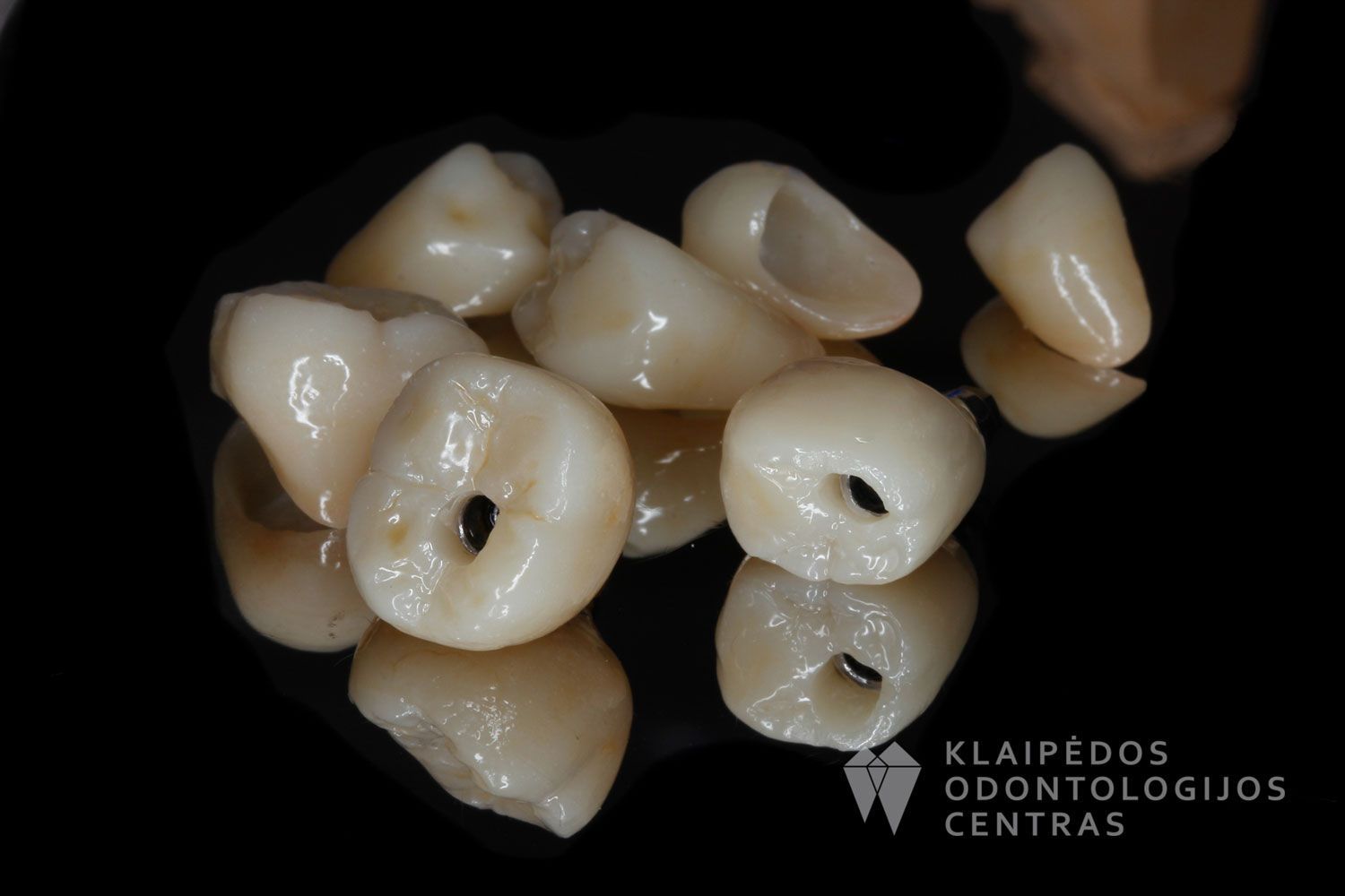 Dantų ir implantų protezavimas cirkonio keramika