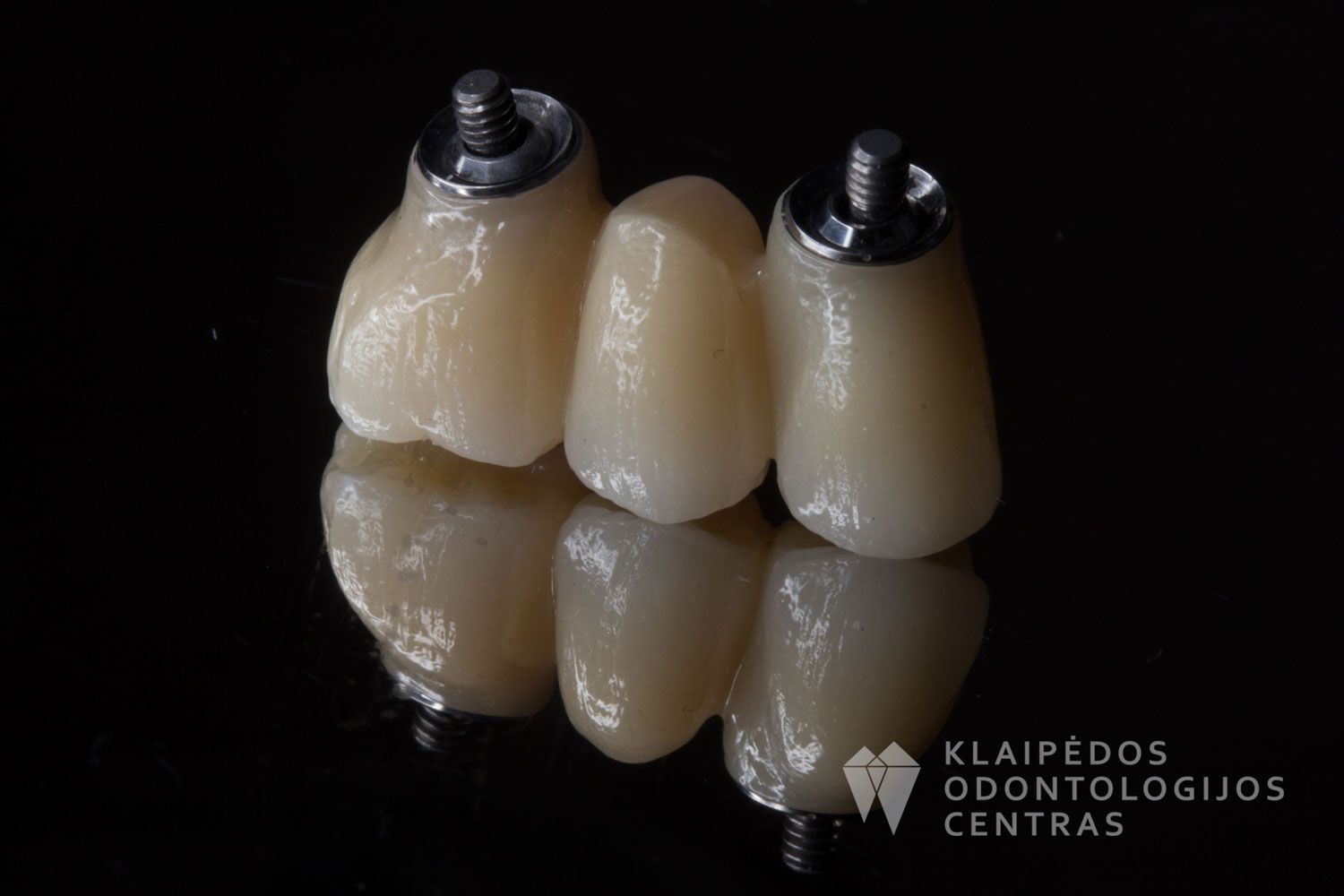 Priekinio danties cirkonio keramika