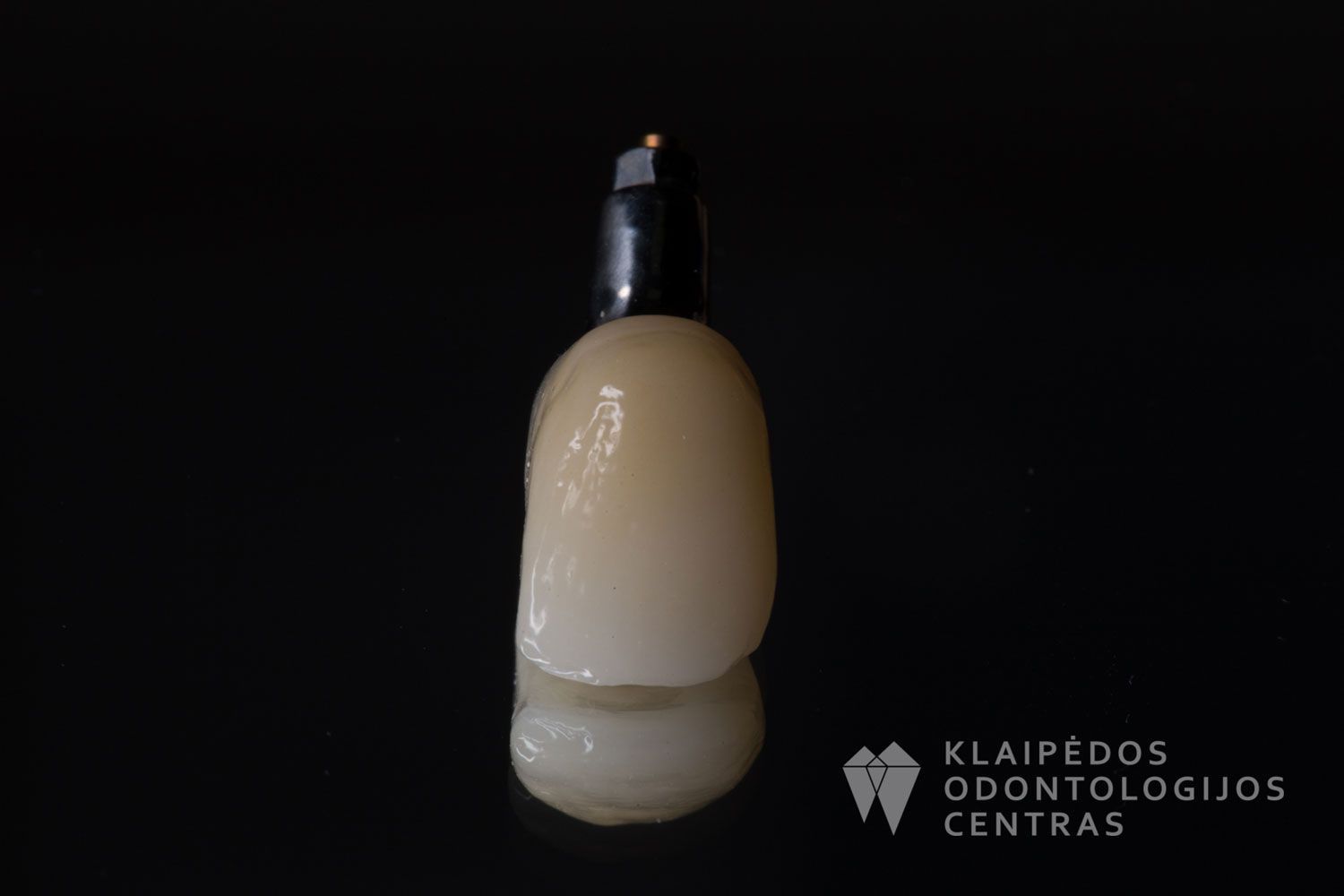 Cirkonio keramikos vainikėlis ant implanto