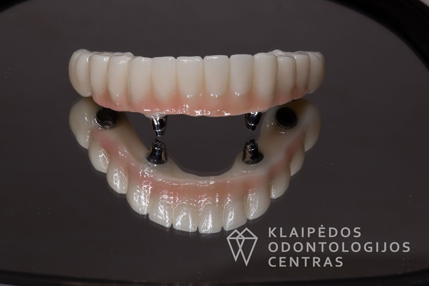 Cirkonio keramika ant 4 implantų