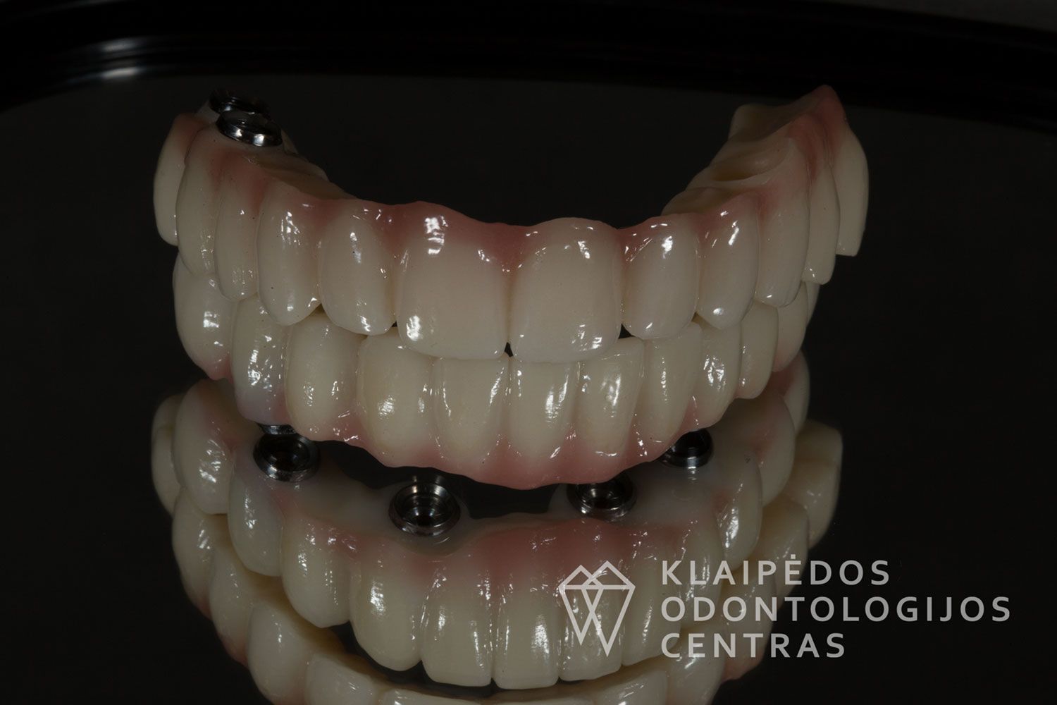 Cirkonio keramika ant 4 implantų