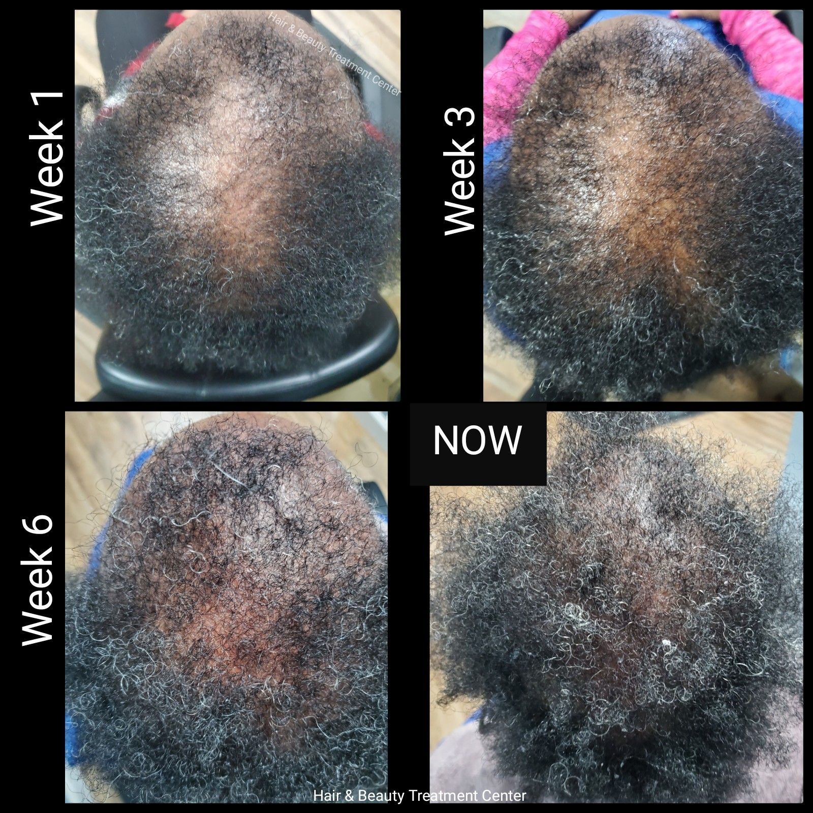 a before and after photo of a person 's hair