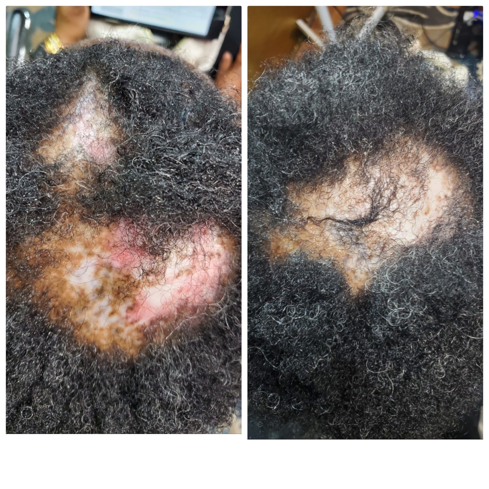 a before and after photo of a person 's hair