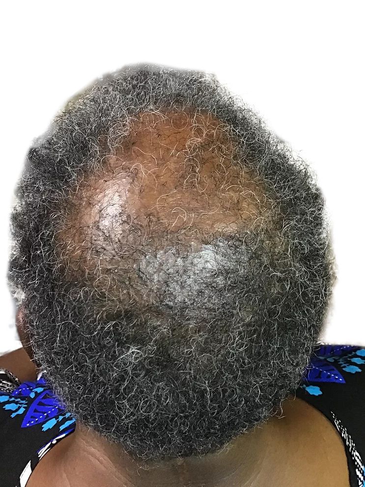 a close up of a woman 's head with gray hair .