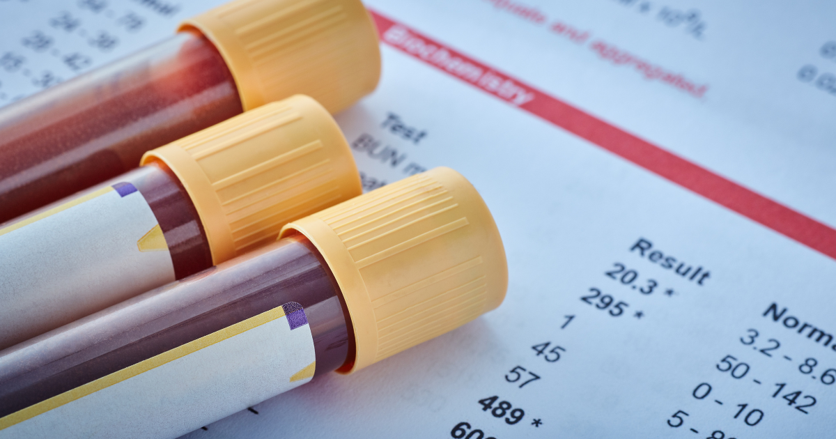Blood sample vials on lab report representing micronutrient testing and health optimization in Las V