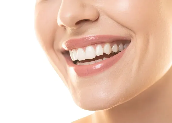 Blanchiment dentaire au laser au cabinet L'Atelier du Sourire à Marrakech