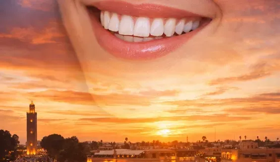 Une bouche souriante et éclatante se superpose à une vue au coucher du soleil d'une ville dominée par un minaret imposant.