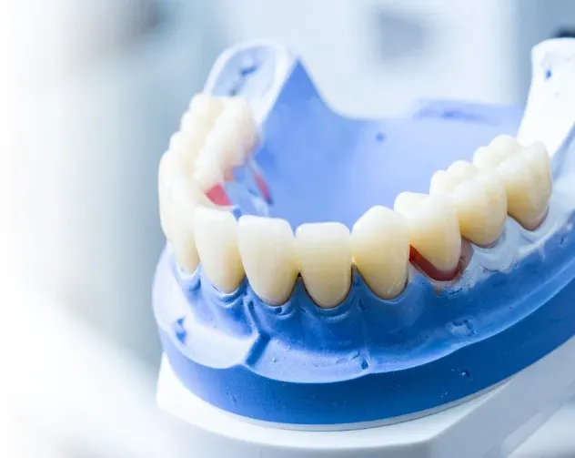 Implant dentaire en titane utilisé par le Dr Belgmair Omar pour la pose d’implants à Marrakech