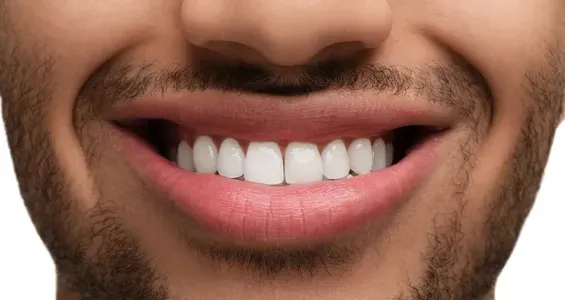Gros plan sur une bouche souriante montrant des dents blanches et droites et une légère barbe de trois jours.