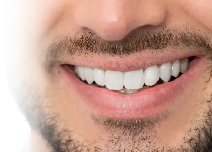 Gros plan sur la bouche d'une personne esquissant un léger sourire, des dents blanches et propres.