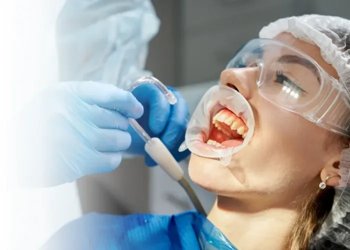 Détartrage dentaire professionnel au cabinet L'Atelier du Sourire à Guéliz, Marrakech