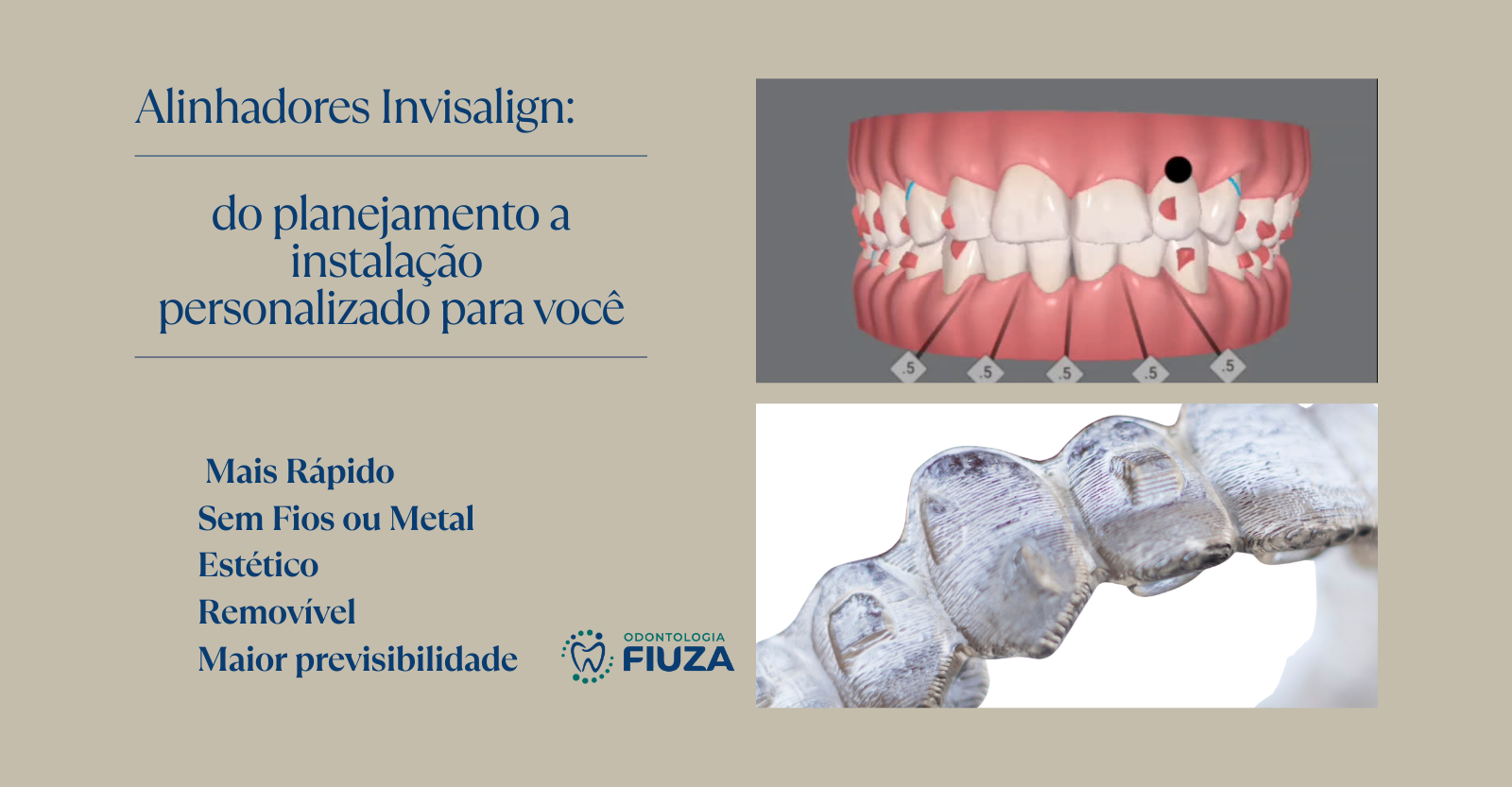 Personalizado para o seu tratamento