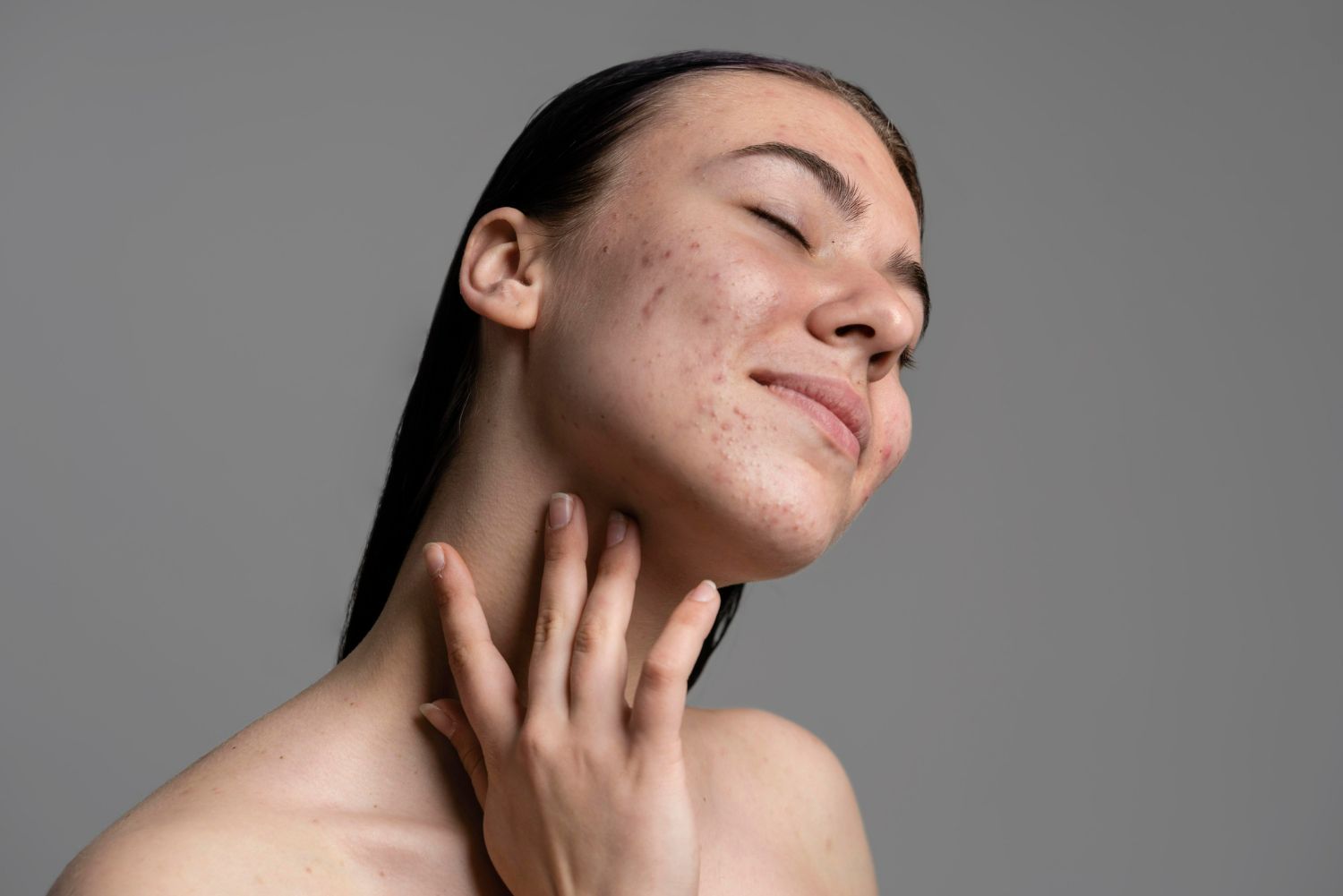 Woman with acne, eyes closed, head tilted, touching her neck with her fingers. Grey background.